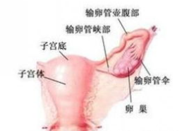 附件炎的治疗方法,附件炎治疗策略全面解析